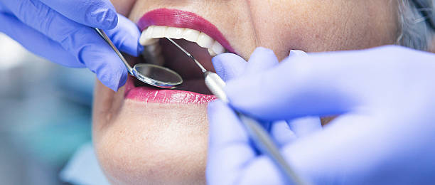 Best Emergency Gum Treatment in Cheverly, MD