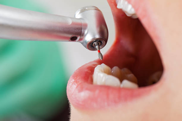 Best Emergency Dental Care for Broken or Chipped Teeth in Cheverly, MD